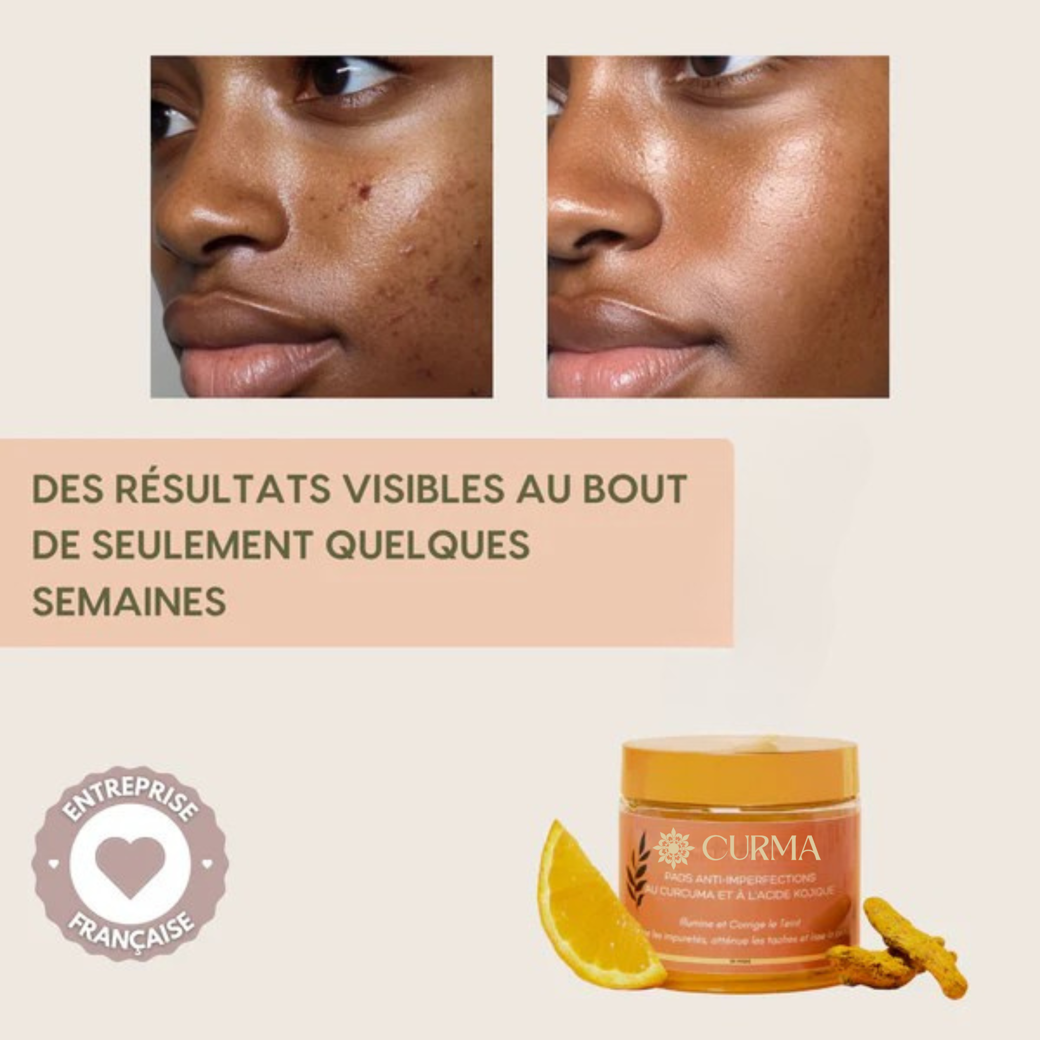 Pads Nettoyants au Curcuma 3 en 1