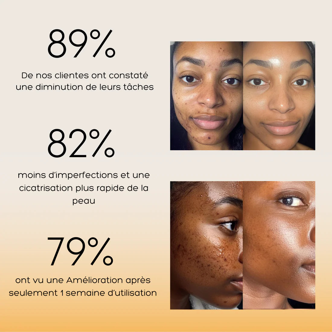 Pads Nettoyants au Curcuma 3 en 1