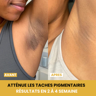 Curma - Mousse Nettoyante Curcuma