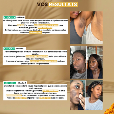 Curma - Savon Anti-Taches